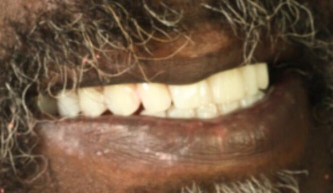 After - Leysroad Dental