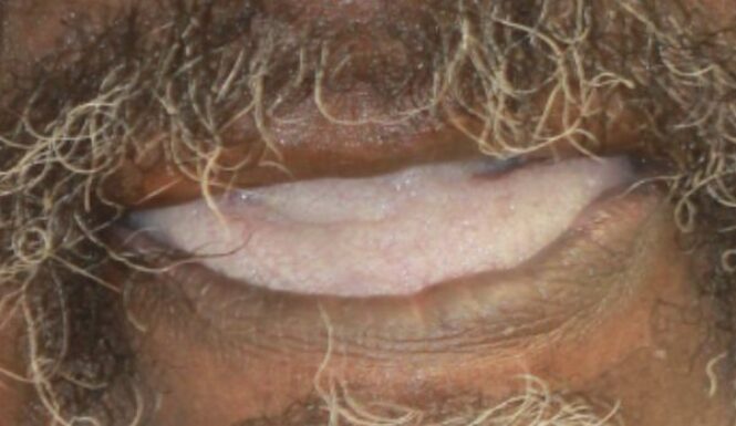 Before - Leysroad Dental