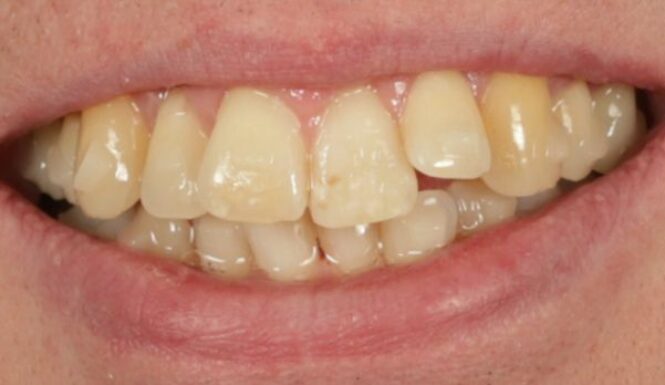 Before - Leysroad Dental