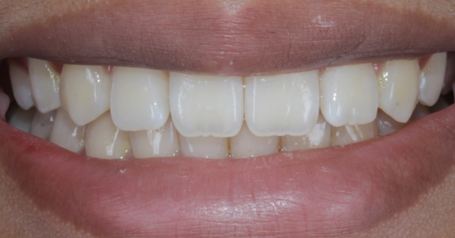 After close up mouth