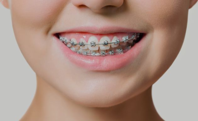 Treatment -  Leysroad Dental