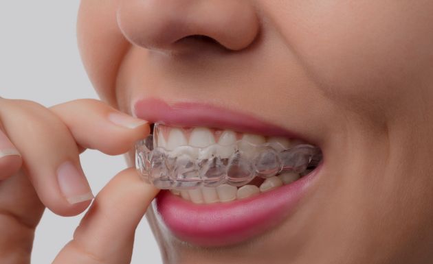 Treatment -  Leysroad Dental