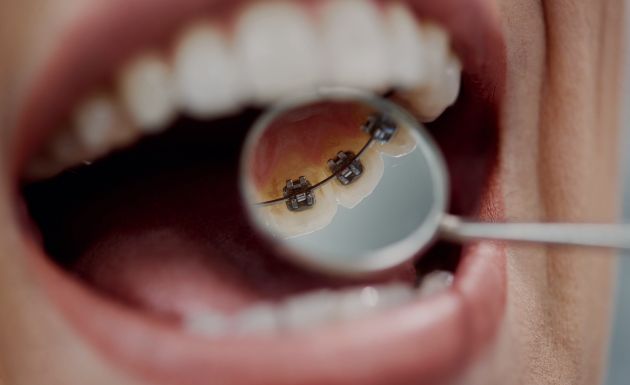 Treatment -  Leysroad Dental