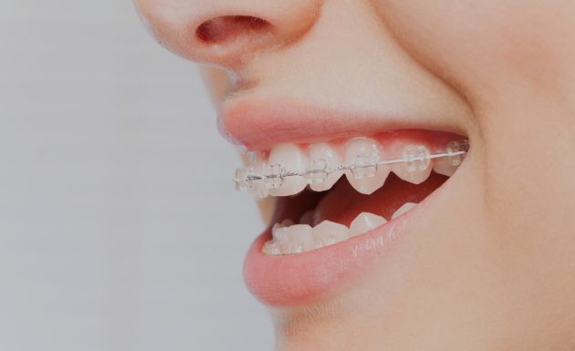 Treatment -  Leysroad Dental