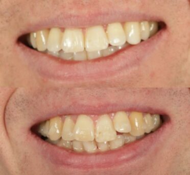 Images by Alexandra Dental