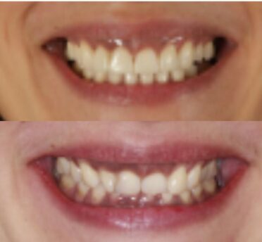 Images by Alexandra Dental.