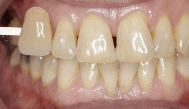 Before - Leysroad Dental