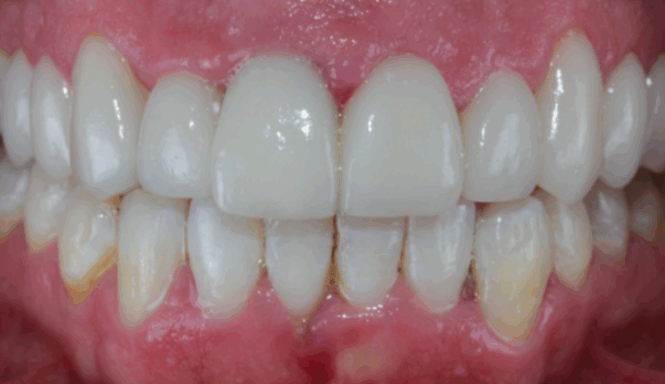 After - Leysroad Dental