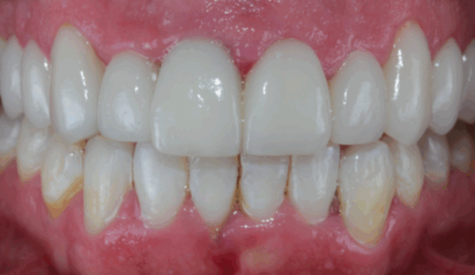After - Leysroad Dental