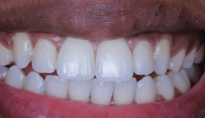 After - Leysroad Dental