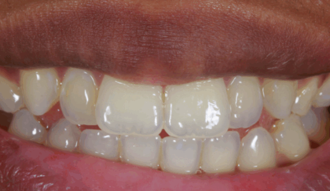 Before - Leysroad Dental