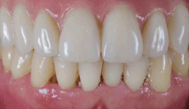 After - Leysroad Dental