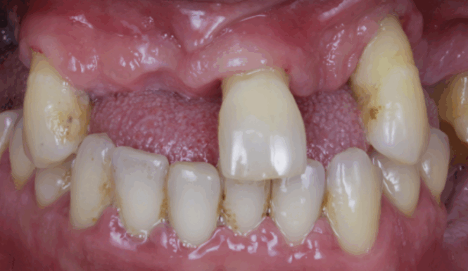 Before - Leysroad Dental