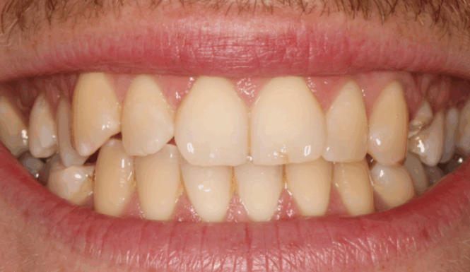 Before - Leysroad Dental