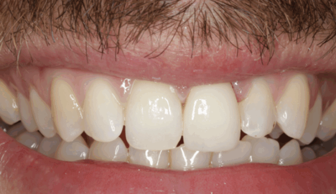 Before - Leysroad Dental