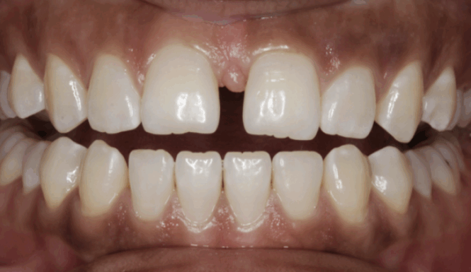 Before - Leysroad Dental